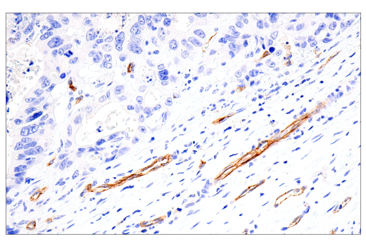 Immunohistochemistry Image 5: IL3RA/CD123 (BR4MS) Mouse mAb