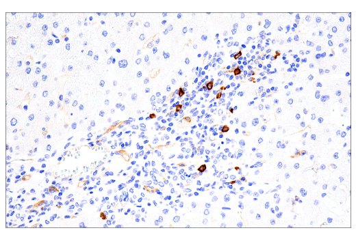 Immunohistochemistry Image 6: IL3RA/CD123 (BR4MS) Mouse mAb