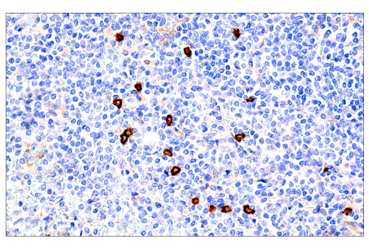 Immunohistochemistry Image 1: IL3RA/CD123 (BR4MS) Mouse mAb