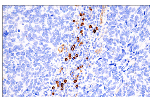 Immunohistochemistry Image 2: IL3RA/CD123 (BR4MS) Mouse mAb