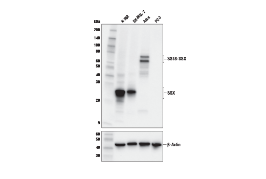 Western Blotting Image 1: SSX (E5A2C) Rabbit mAb (Carboxy-terminal Antigen)