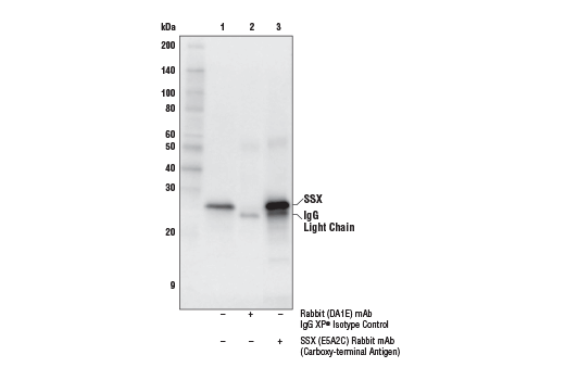 Immunoprecipitation Image 1: SSX (E5A2C) Rabbit mAb (Carboxy-terminal Antigen)