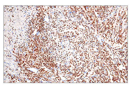 Immunohistochemistry Image 1: SSX (E5A2C) Rabbit mAb (Carboxy-terminal Antigen)