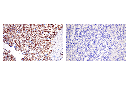 Immunohistochemistry Image 3: SSX (E5A2C) Rabbit mAb (Carboxy-terminal Antigen)