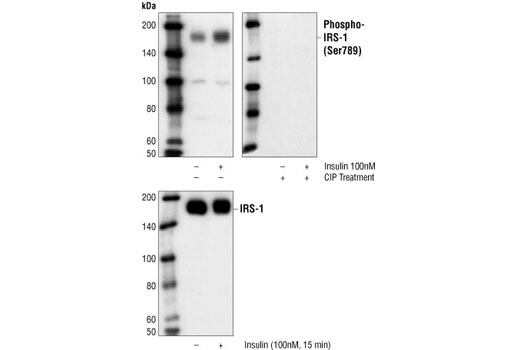 Western Blotting Image 1: Phospho-IRS-1 (Ser789) Antibody