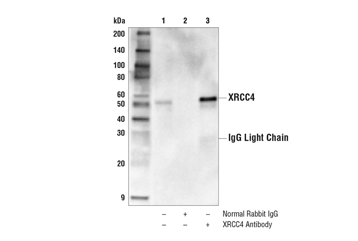 Immunoprecipitation Image 1: XRCC4 Antibody