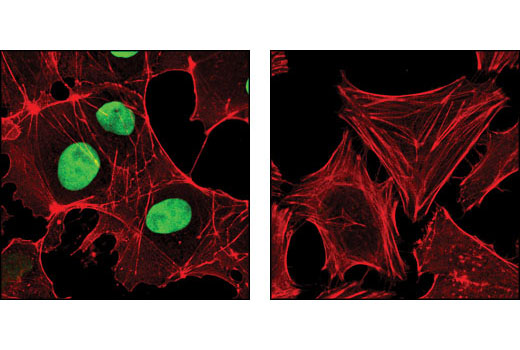 Immunofluorescence Image 1: Sox2 (D6D9) XP® Rabbit mAb (BSA and Azide Free)