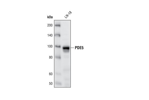 Western Blotting Image 1: PDE5 Antibody