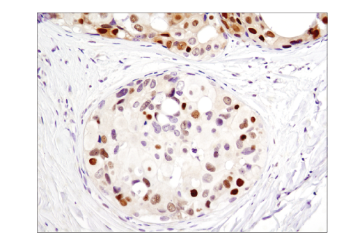 Immunohistochemistry Image 1: CDK4 (D9G3E) Rabbit mAb (BSA and Azide Free)