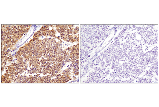 Immunohistochemistry Image 2: CDK4 (D9G3E) Rabbit mAb (BSA and Azide Free)