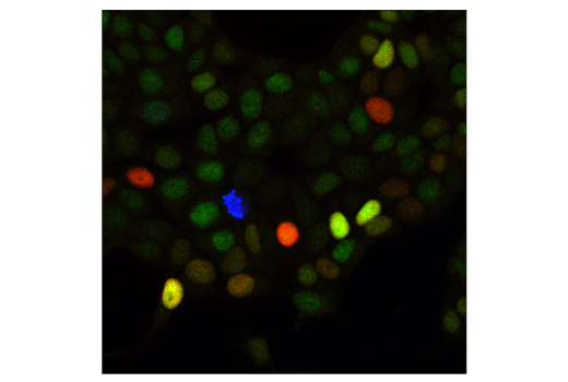 Immunofluorescence Image 1: CDK4 (D9G3E) Rabbit mAb (BSA and Azide Free)