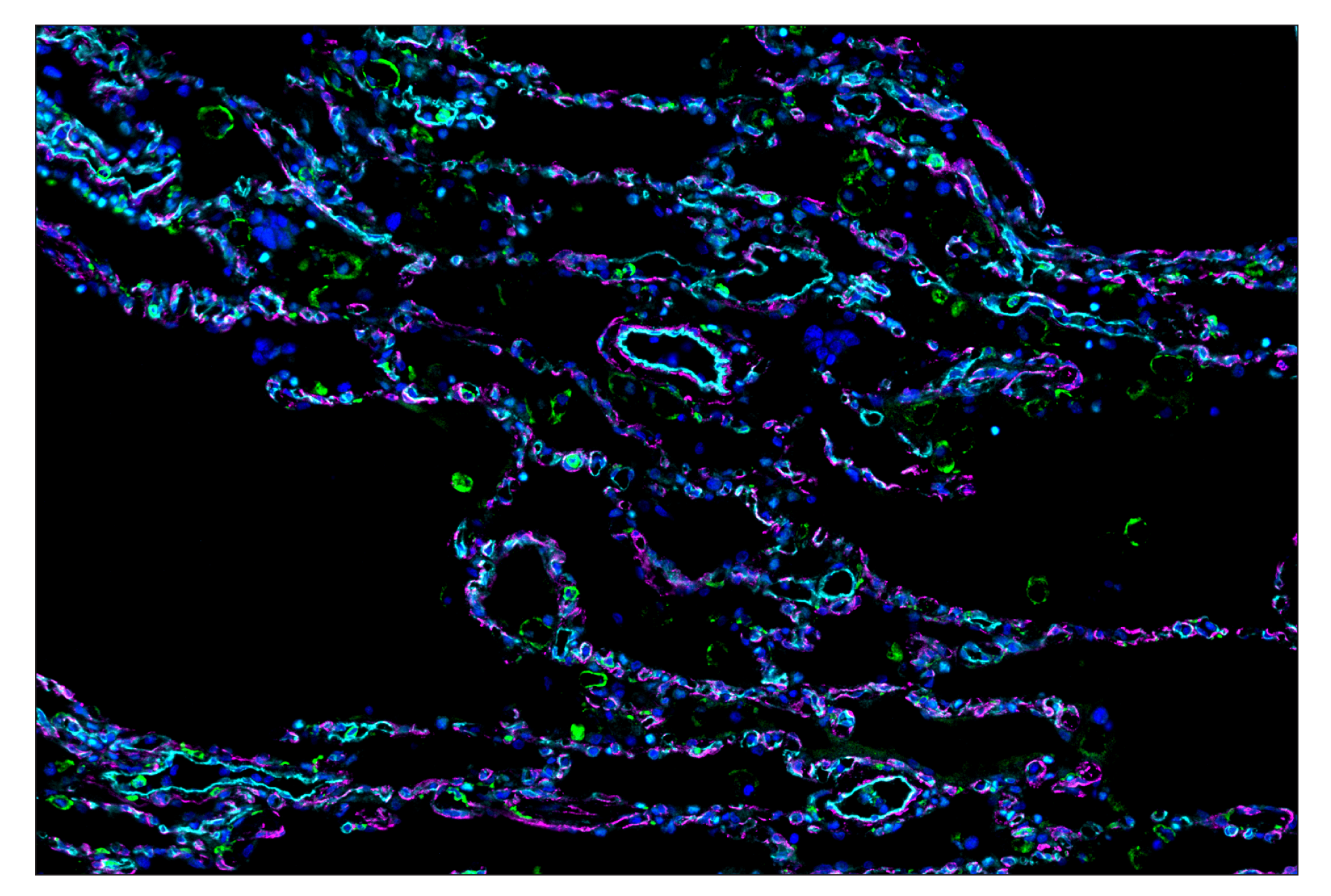 Immunohistochemistry Image 8: CD14 (D7A2T) & CO-0085-594 SignalStar™ Oligo-Antibody Pair
