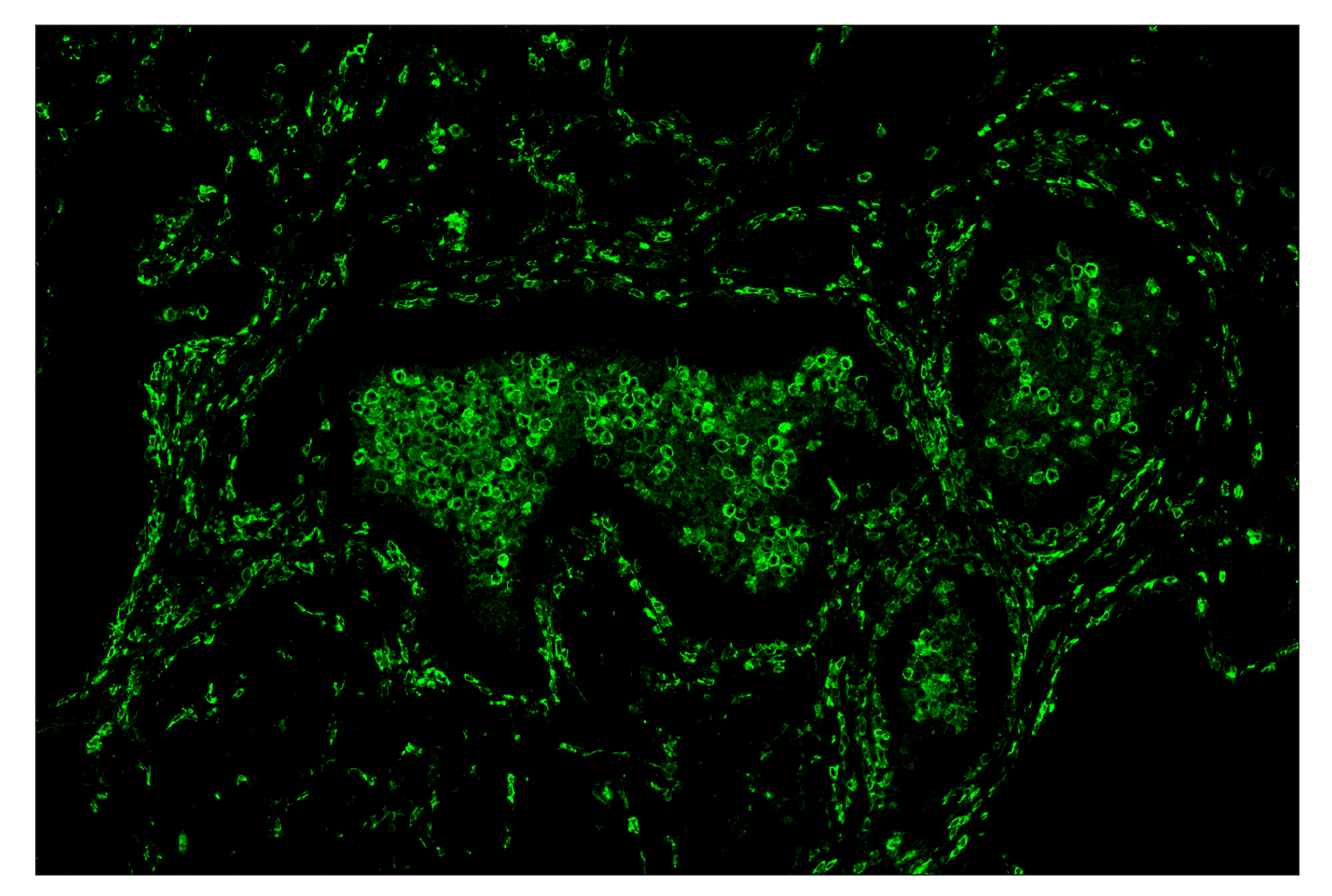 Immunohistochemistry Image 2: CD14 (D7A2T) & CO-0085-594 SignalStar™ Oligo-Antibody Pair