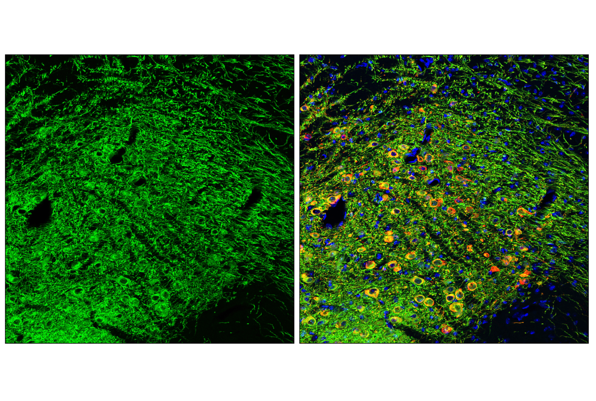 Immunofluorescence Image 2: Dopamine Transporter/DAT (E3U7R) Rabbit mAb