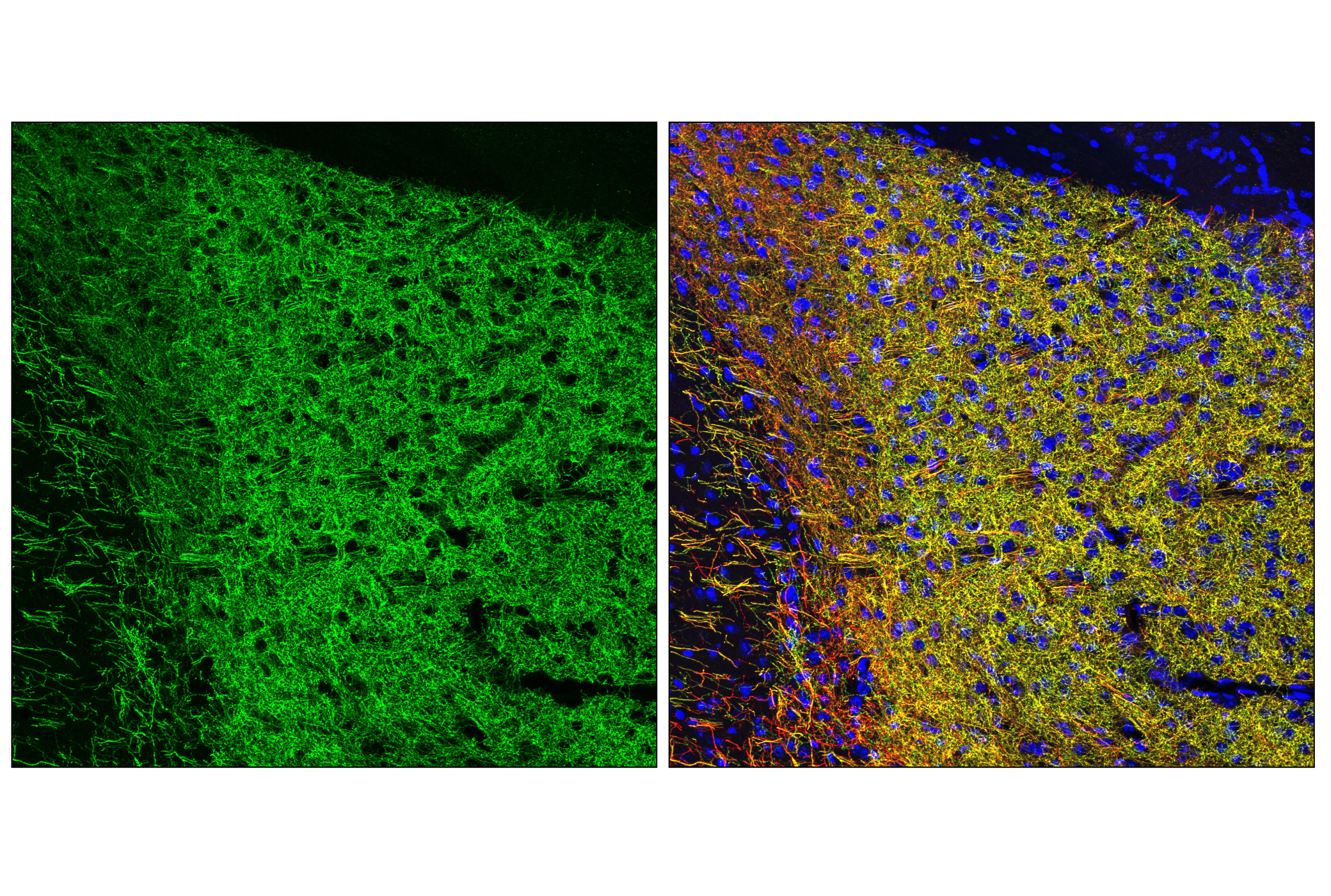 Immunofluorescence Image 1: Dopamine Transporter/DAT (E3U7R) Rabbit mAb