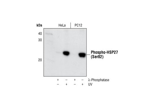Western Blotting Image 1: Phospho-HSP27 (Ser82) Antibody II