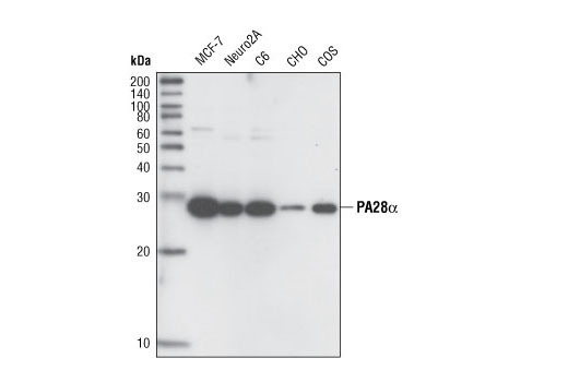 Western Blotting Image 1: PA28α Antibody