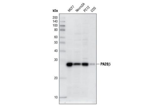 Western Blotting Image 1: PA28β Antibody