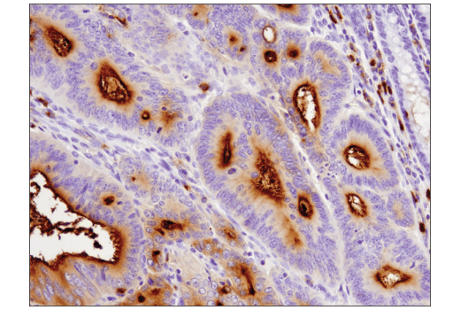 Immunohistochemistry Image 1: CEACAM1 (D3R8O) Rabbit mAb (BSA and Azide Free)