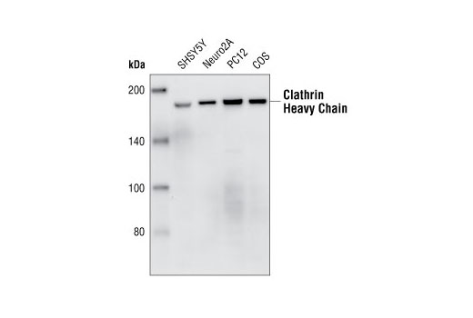 Western Blotting Image 1: Clathrin Heavy Chain (P1663) Antibody