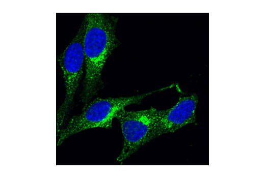 Immunofluorescence Image 1: Clathrin Heavy Chain (P1663) Antibody
