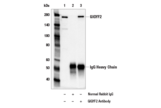 Immunoprecipitation Image 1: GIGYF2 Antibody