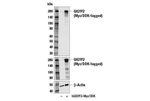 Western Blotting Image 3: GIGYF2 Antibody