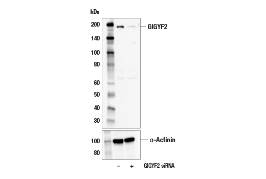 Western Blotting Image 2: GIGYF2 Antibody