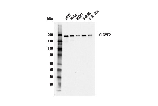 Western Blotting Image 1: GIGYF2 Antibody