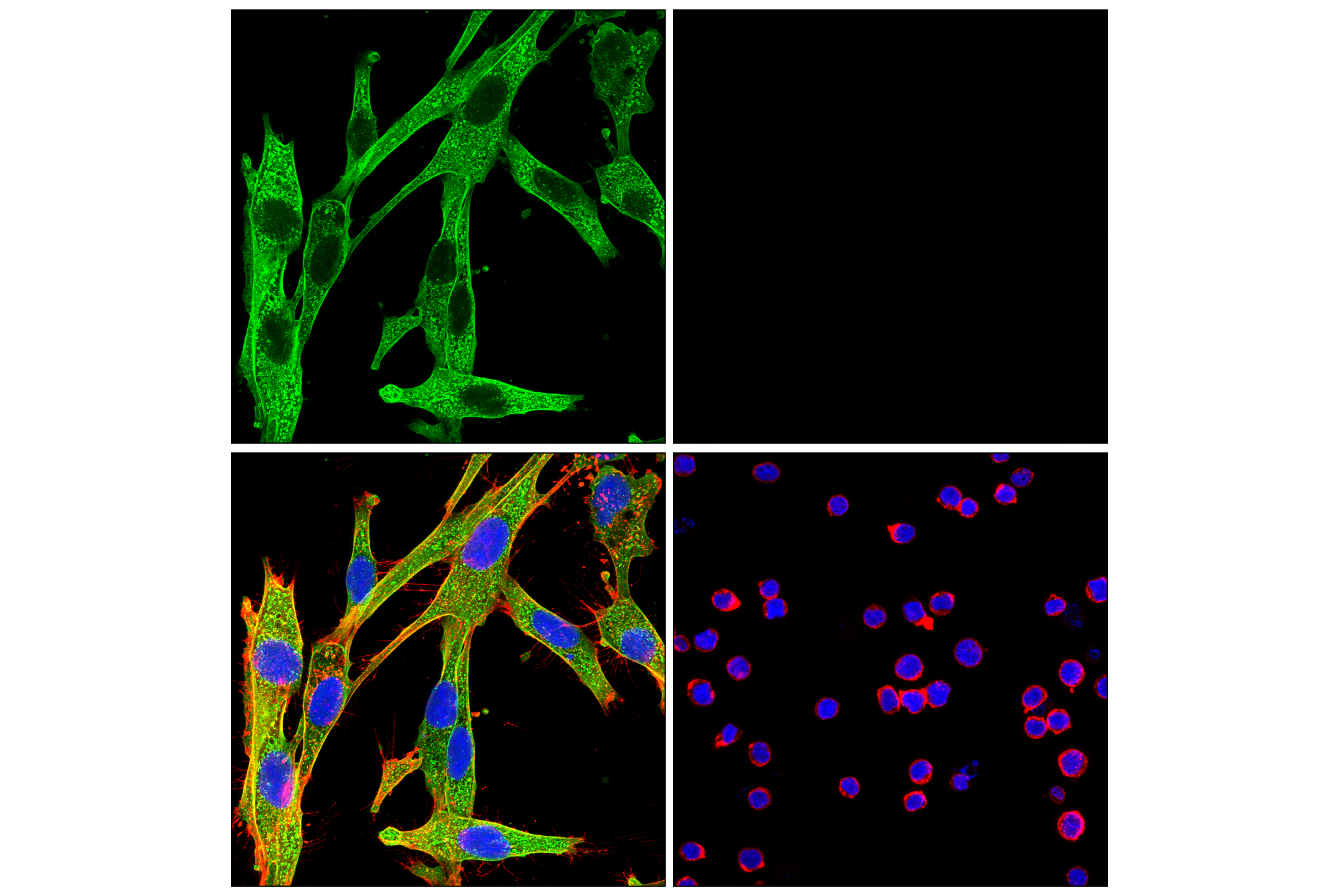 Immunofluorescence Image 1: Annexin V (E3W8V) Rabbit mAb (BSA and Azide Free)