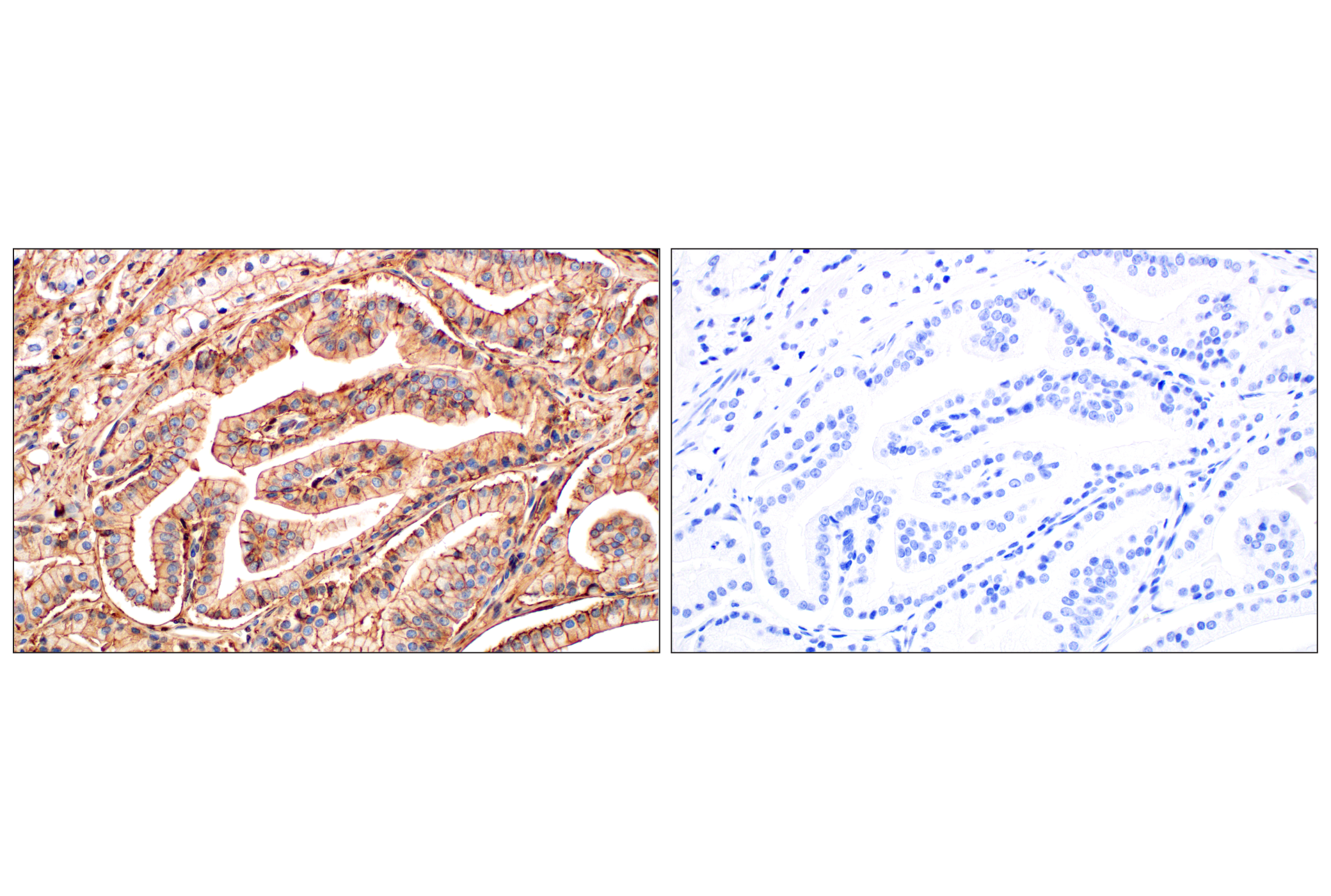 Immunohistochemistry Image 14: Annexin V (E3W8V) Rabbit mAb (BSA and Azide Free)