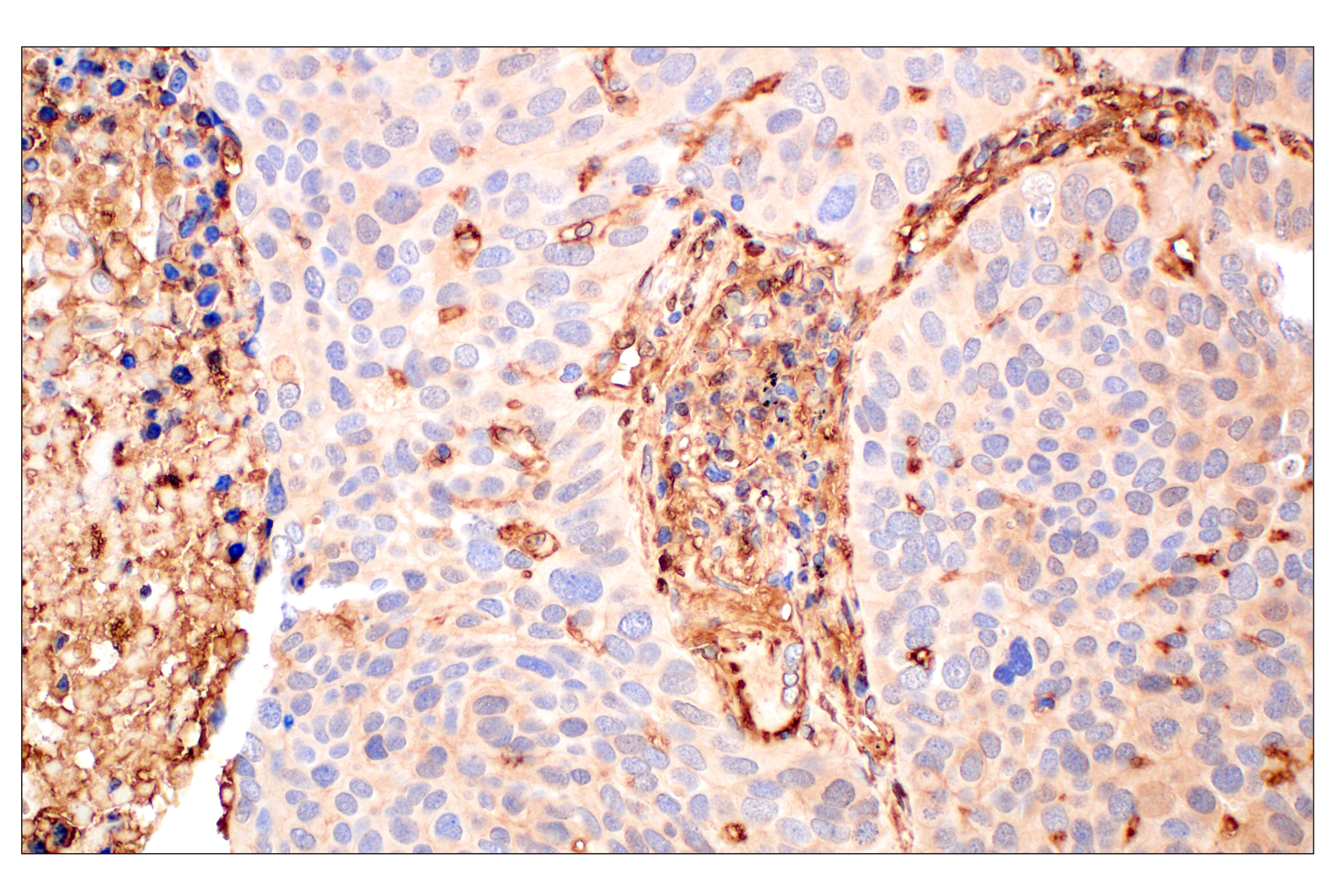 Immunohistochemistry Image 2: Annexin V (E3W8V) Rabbit mAb (BSA and Azide Free)
