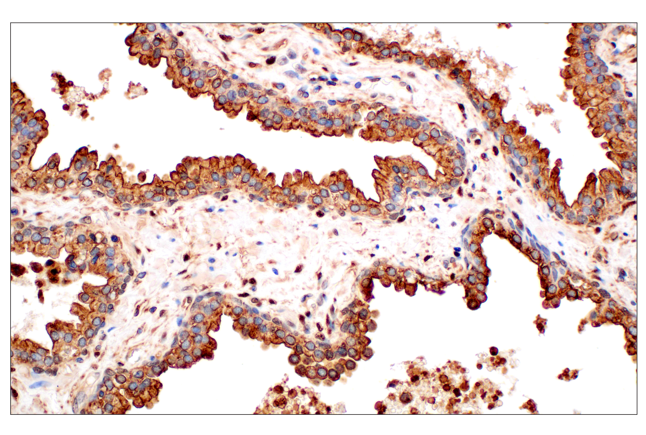 Immunohistochemistry Image 3: Annexin V (E3W8V) Rabbit mAb (BSA and Azide Free)