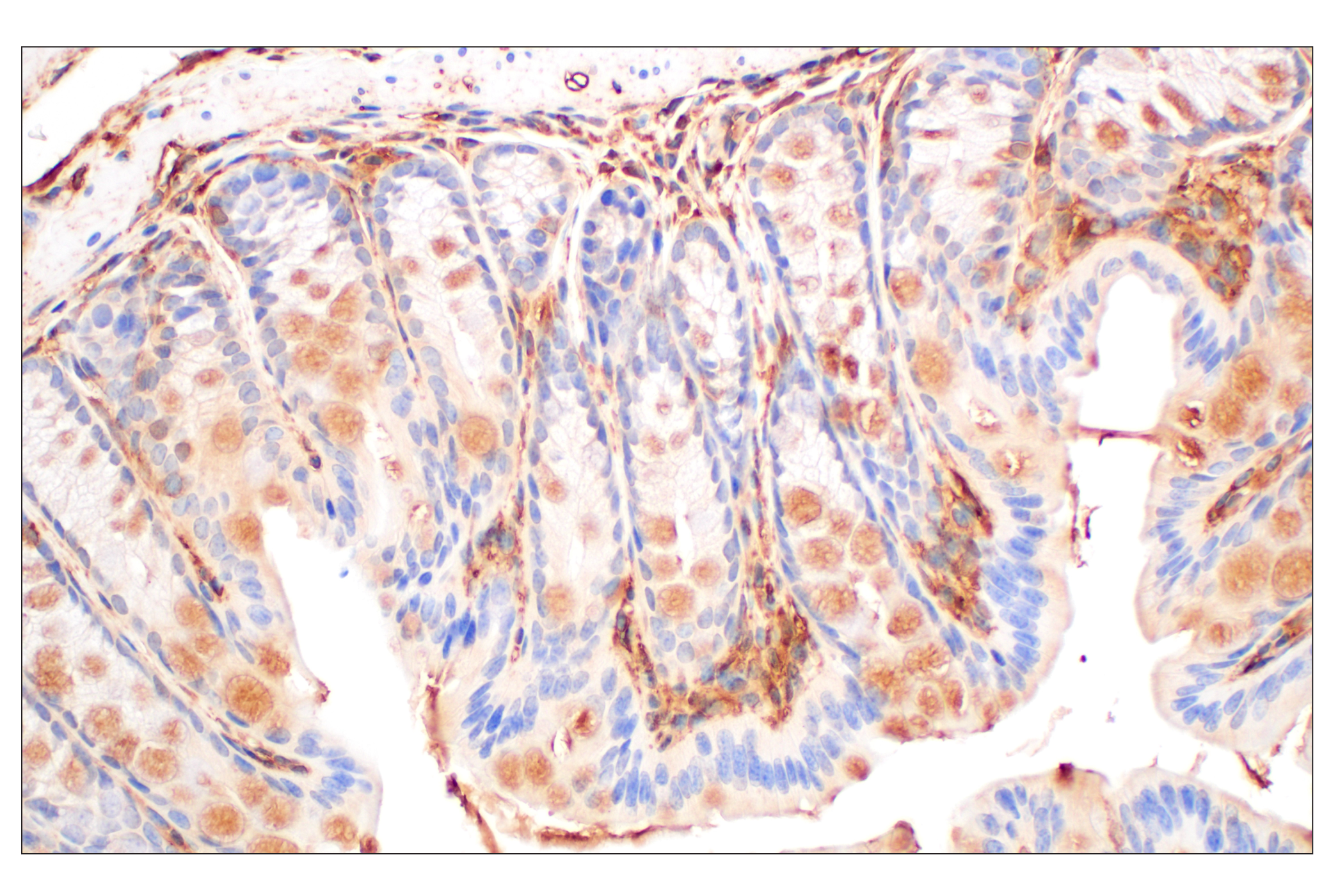 Immunohistochemistry Image 13: Annexin V (E3W8V) Rabbit mAb (BSA and Azide Free)
