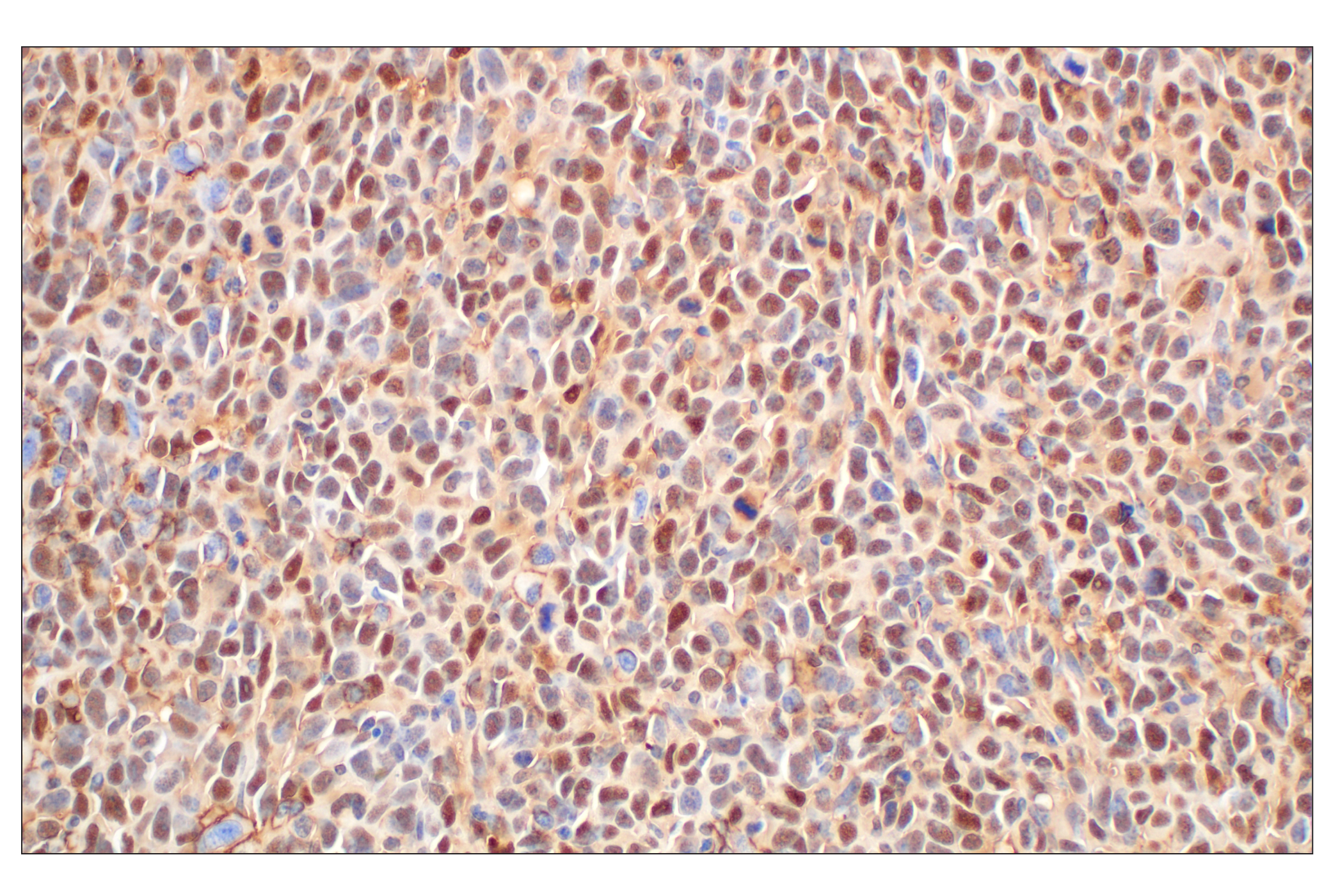 Immunohistochemistry Image 10: Annexin V (E3W8V) Rabbit mAb (BSA and Azide Free)