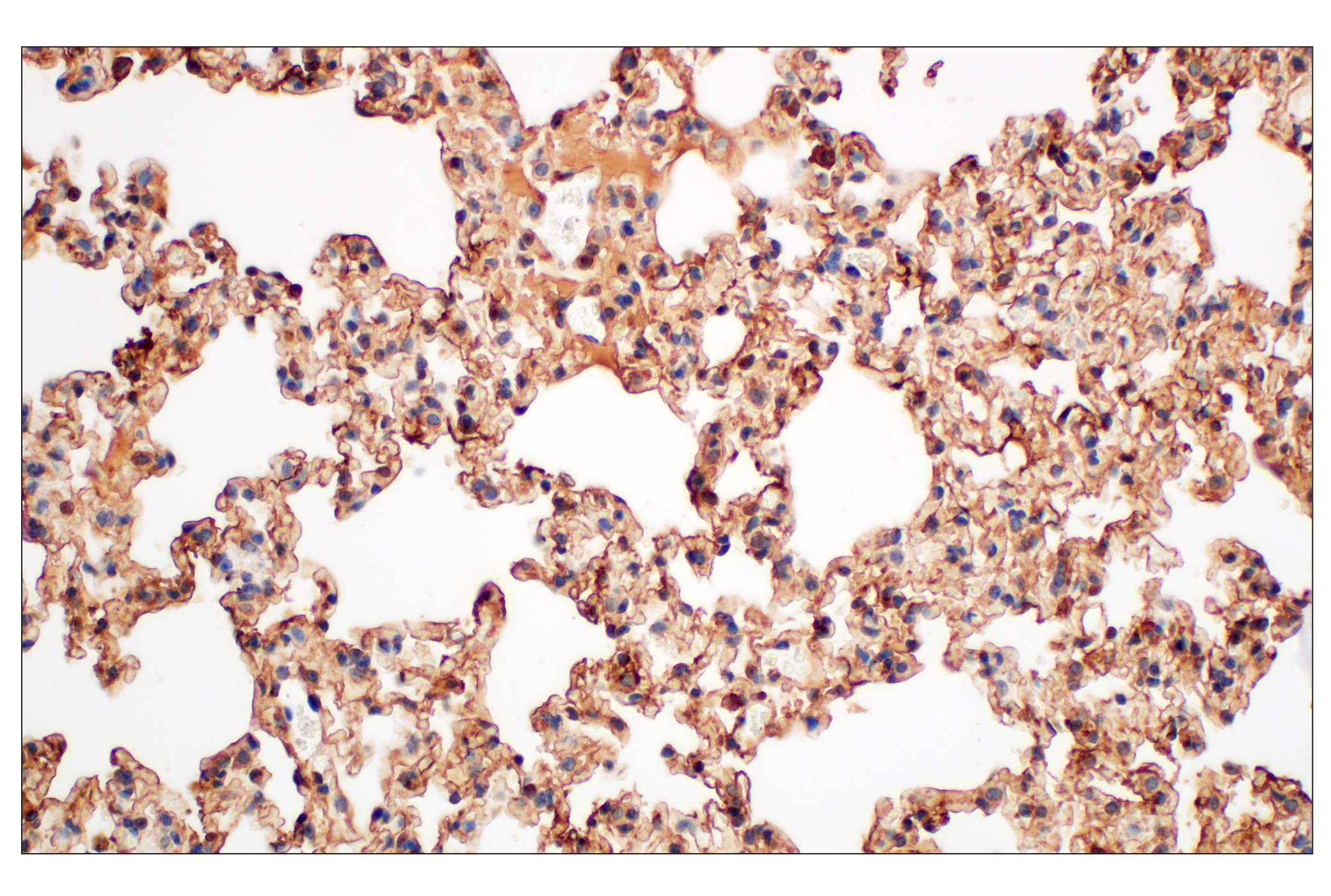 Immunohistochemistry Image 11: Annexin V (E3W8V) Rabbit mAb (BSA and Azide Free)