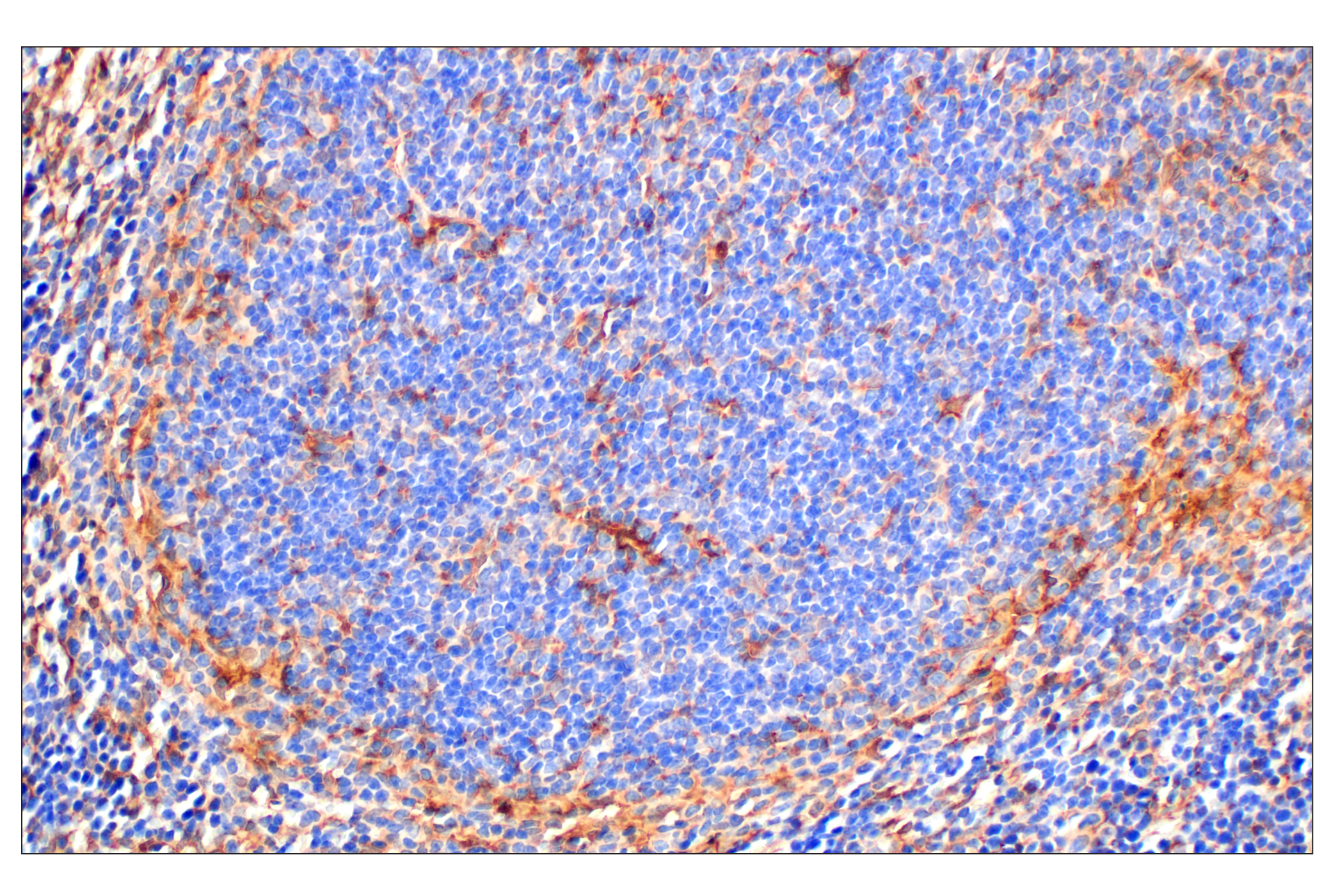 Immunohistochemistry Image 12: Annexin V (E3W8V) Rabbit mAb (BSA and Azide Free)