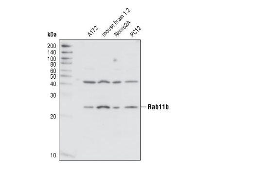 Western Blotting Image 1: Rab11b Antibody