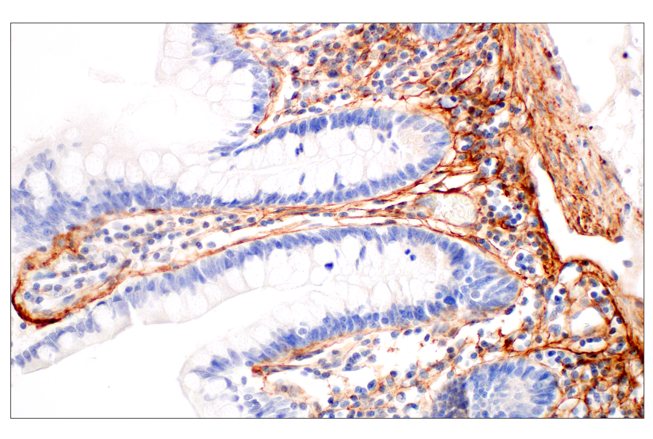 Immunohistochemistry Image 7: Tenascin C (E6N4L) Rabbit mAb (BSA and Azide Free)