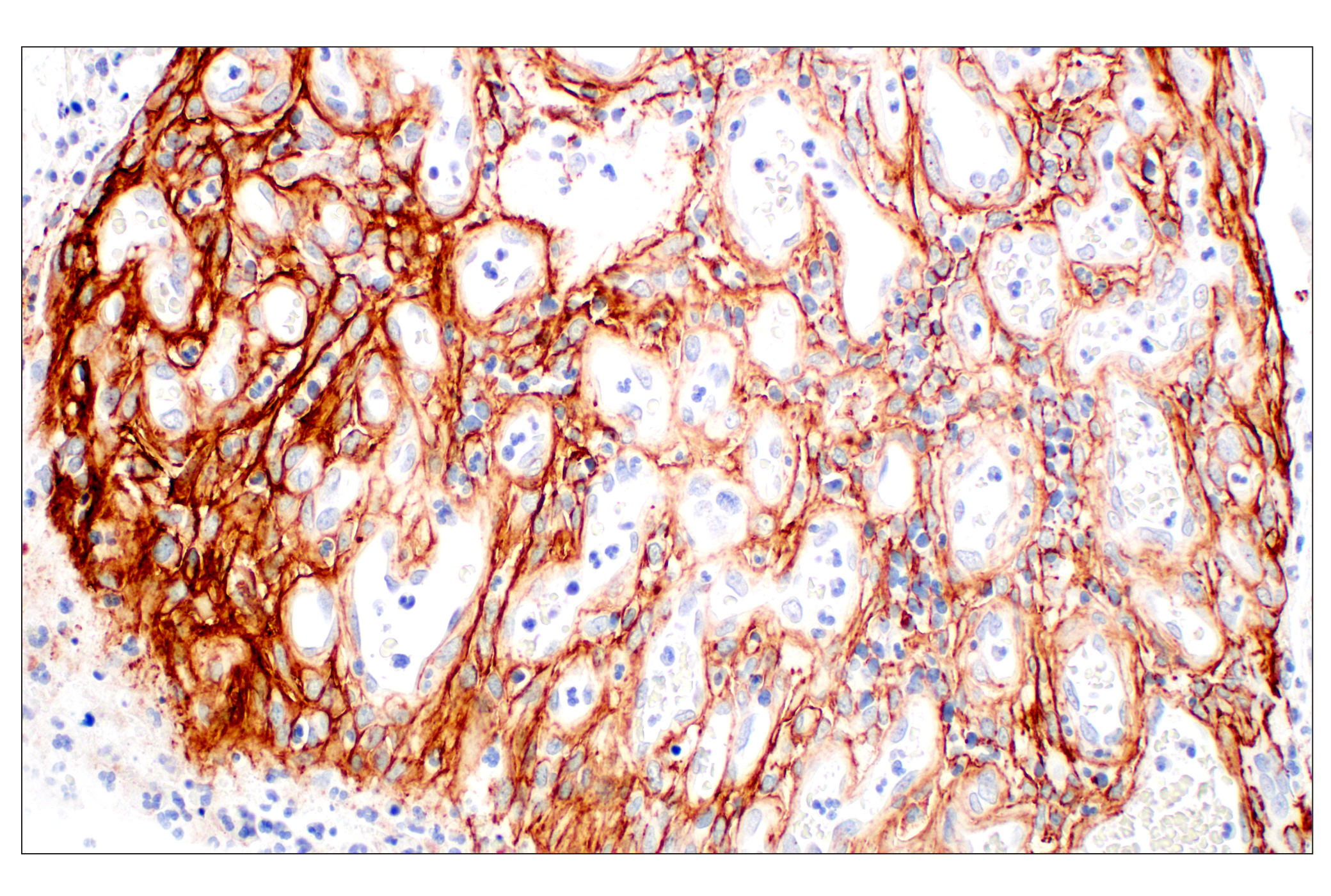 Immunohistochemistry Image 2: Tenascin C (E6N4L) Rabbit mAb (BSA and Azide Free)