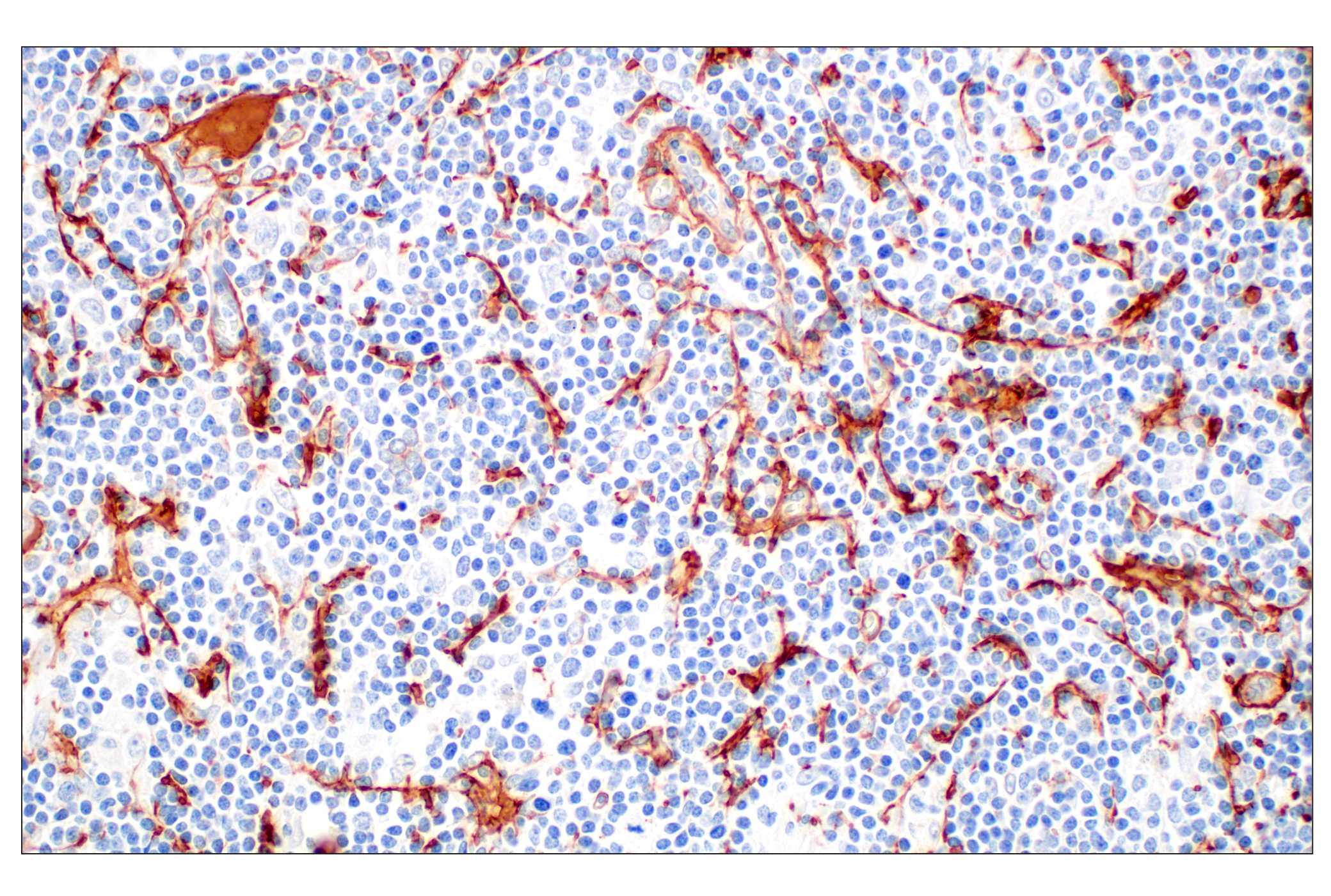 Immunohistochemistry Image 4: Tenascin C (E6N4L) Rabbit mAb (BSA and Azide Free)