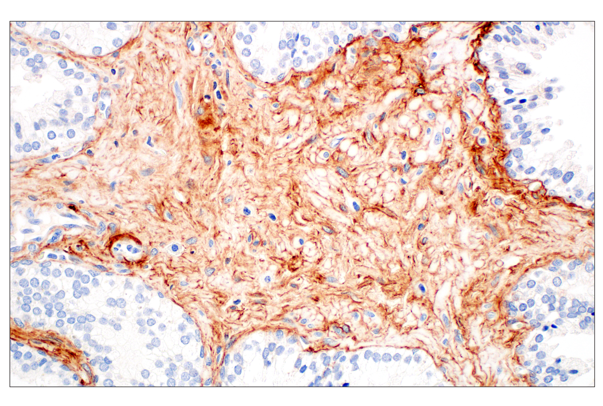 Immunohistochemistry Image 1: Tenascin C (E6N4L) Rabbit mAb (BSA and Azide Free)