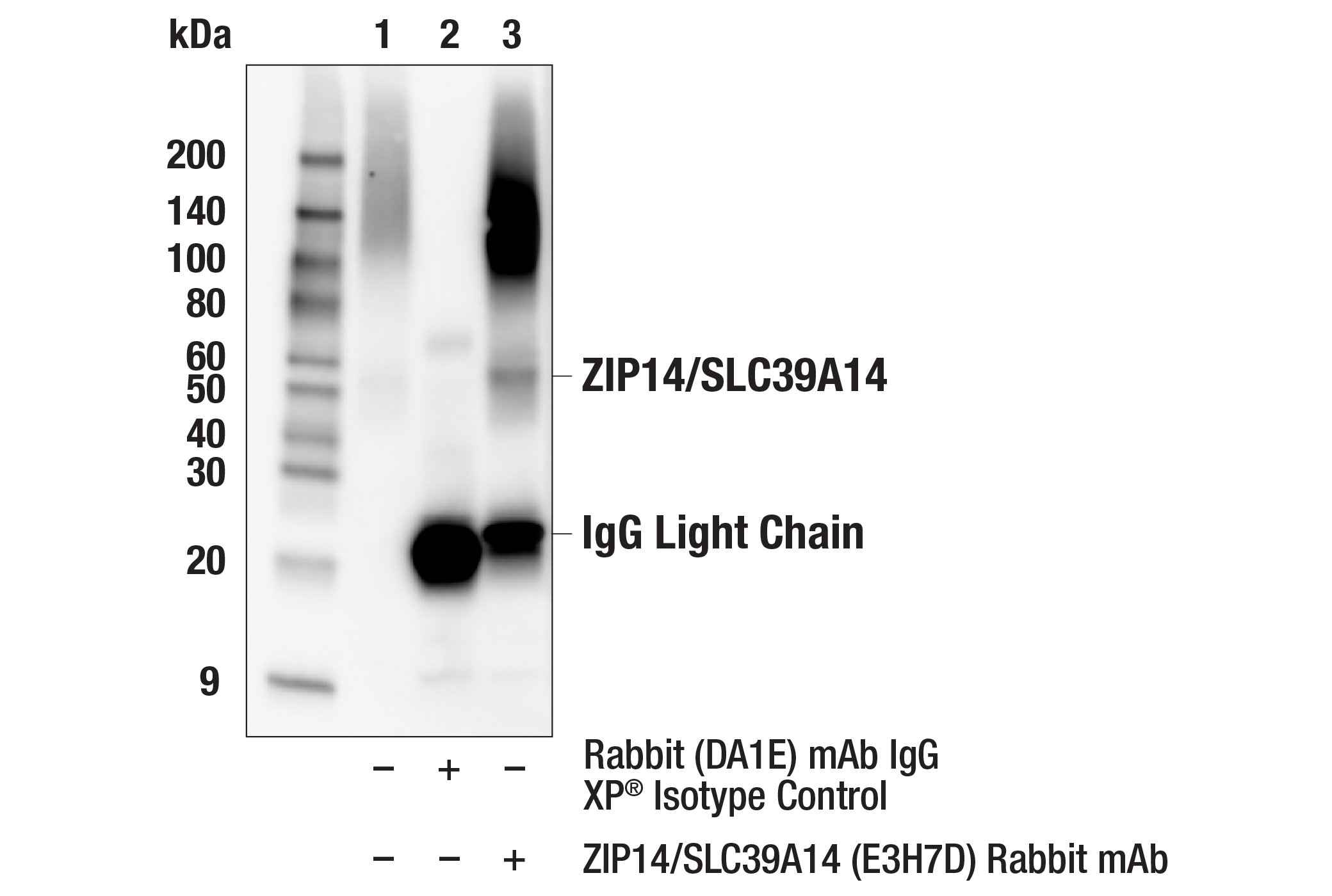 Immunoprecipitation Image 1: ZIP14/SLC39A14 (E3H7D) Rabbit mAb