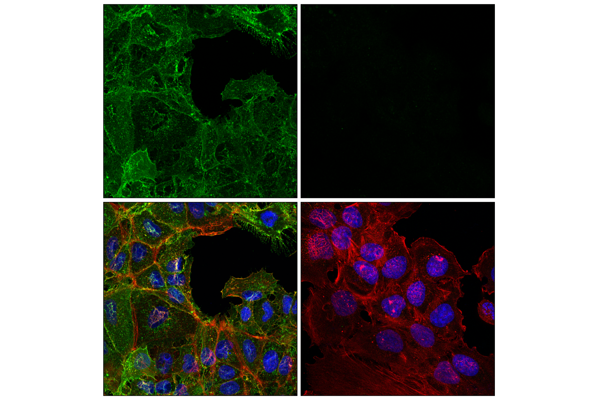 Immunofluorescence Image 1: ZIP14/SLC39A14 (E3H7D) Rabbit mAb