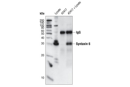 Immunoprecipitation Image 1: Syntaxin 6 Antibody