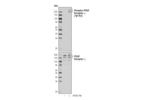 Western Blotting Image 1: Phospho-PDGF Receptor α (Tyr762) (D9B1N) Rabbit mAb