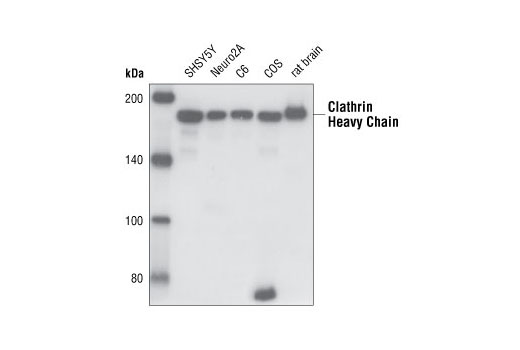 Western Blotting Image 1: Clathrin Heavy Chain (I67) Antibody