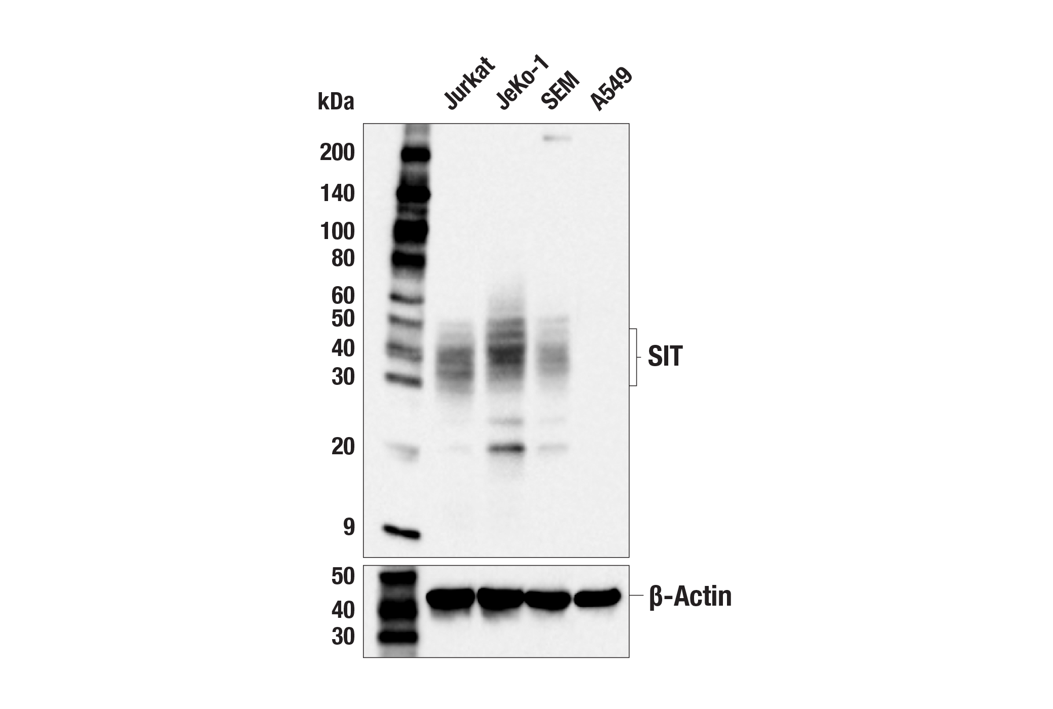 Western Blotting Image 1: SIT Antibody