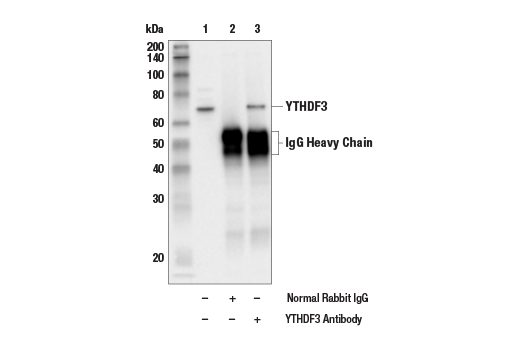  Image 1: N6-Methyladenosine (m6A) Binding Protein Antibody Sampler Kit