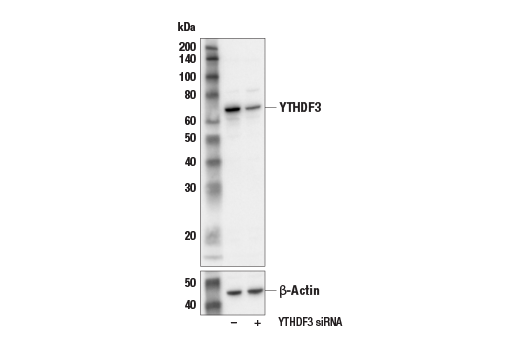  Image 2: N6-Methyladenosine (m6A) Binding Protein Antibody Sampler Kit